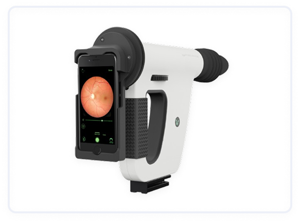Fundus Cameras