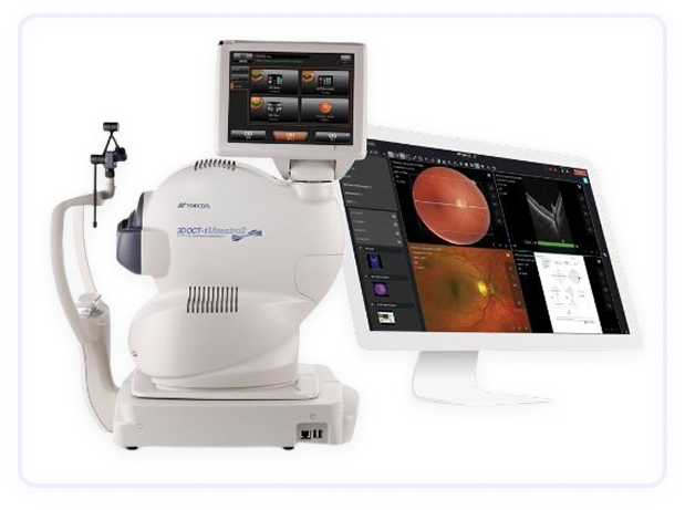 Optical Coherence Tomography (OCT)