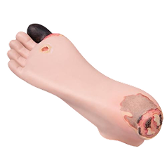 Wound Care and Dressing Models
